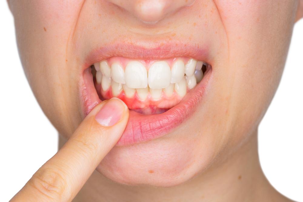 Plantas e higiene dental: historia, no un remedio